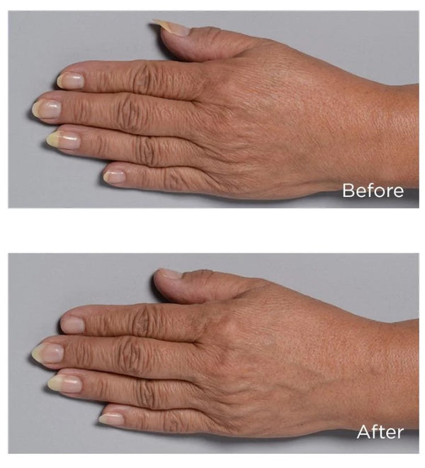 Perricone MD Cold Plasma+ Hand Therapy 59 ml