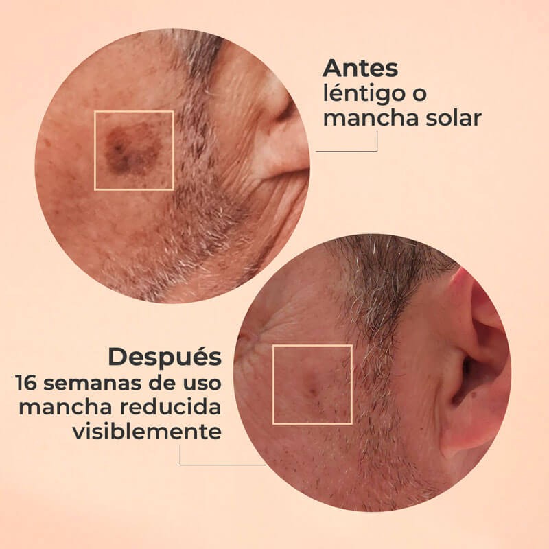 Segle Glicolmix Peeling 30 ml