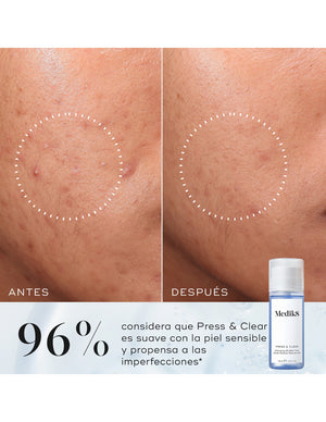 Medik8 Press & Clear 150 ml