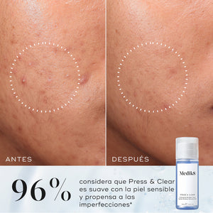 Medik8 Press & Clear 150 ml