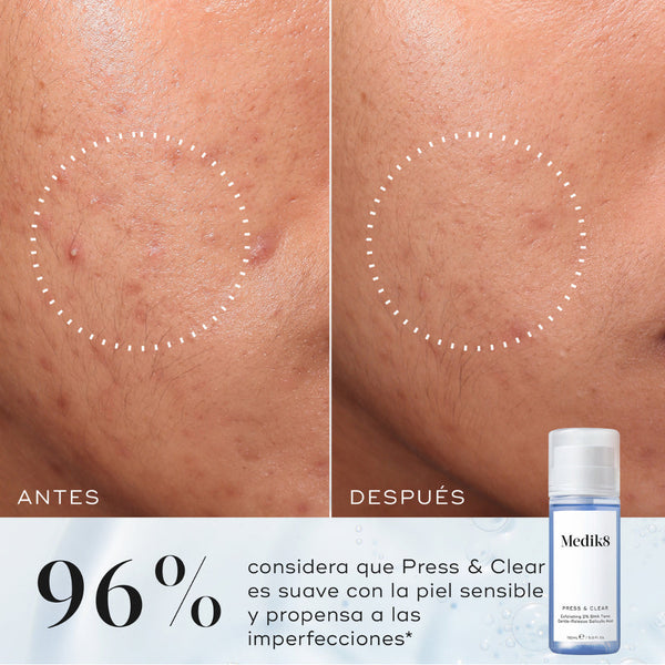 Medik8 Press & Clear 150 ml