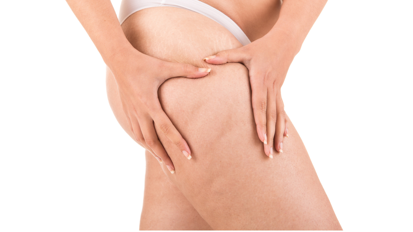 ¿Que diferencias tienen los anticelulíticos Uniskin y Glo910?