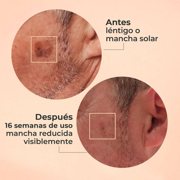 Segle Glicolmix Peeling 30 ml