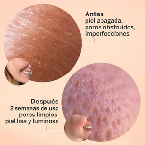 Segle Glicolmix Peeling 30 ml