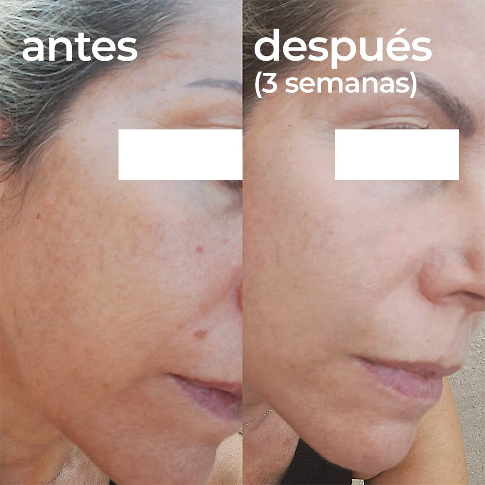 Segle Clinical Clear Skin R Gel Crema 30 ml