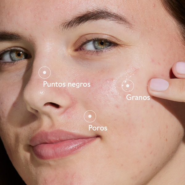Caudalie Vinopure Sérum salicílico anti-imperfecciones 30 ml