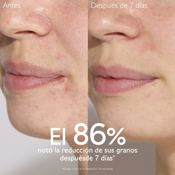 Caudalie Vinopure Sérum salicílico anti-imperfecciones 30 ml