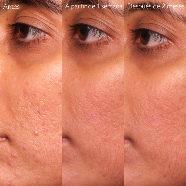 Caudalie Vinopure Sérum salicílico anti-imperfecciones 30 ml