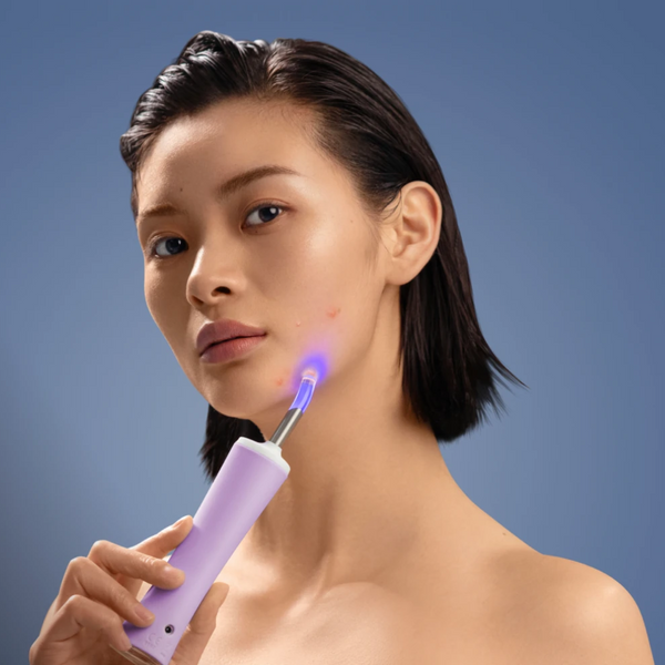 Foreo ESPADA™ 2 Plus Dispositivo de tratamiento para el acné con luz LED azul Lavender