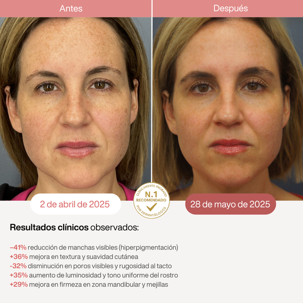 Eternas Máscara LED Infrarroja Profesional - 850nm - 2