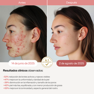 Eternas Máscara LED Infrarroja Profesional - 850nm - 4