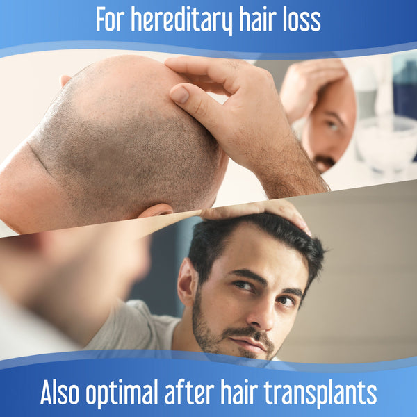 Hairfluencer Spray Hairforte Hombre 3% Procapil - 4