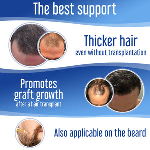 Hairfluencer Spray Hairforte Hombre 3% Procapil - 7