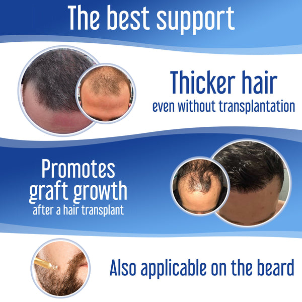 Hairfluencer Spray Hairforte Hombre 3% Procapil - 7