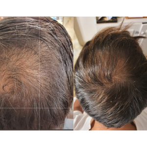 Luxmetique Hair Formula 60 cápsulas