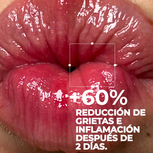 Segle Lip Balm Repair Ultra Centella Peach 10 ml - 3