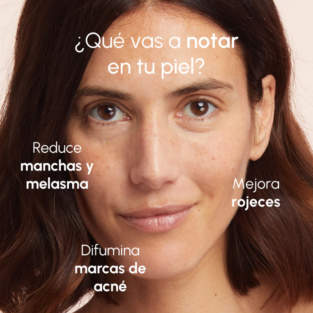 Two Poles Pack Granitos y Marcas de acné