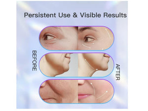 Innova Gizmo Masajeador facial lifting EMS