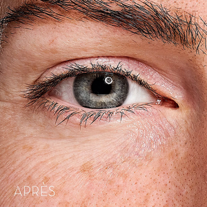 Skin Office Eye Recipe Contorno de ojos 20 ml